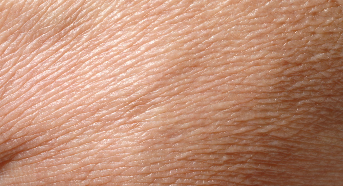 A close up image of fine surface level facial wrinkles