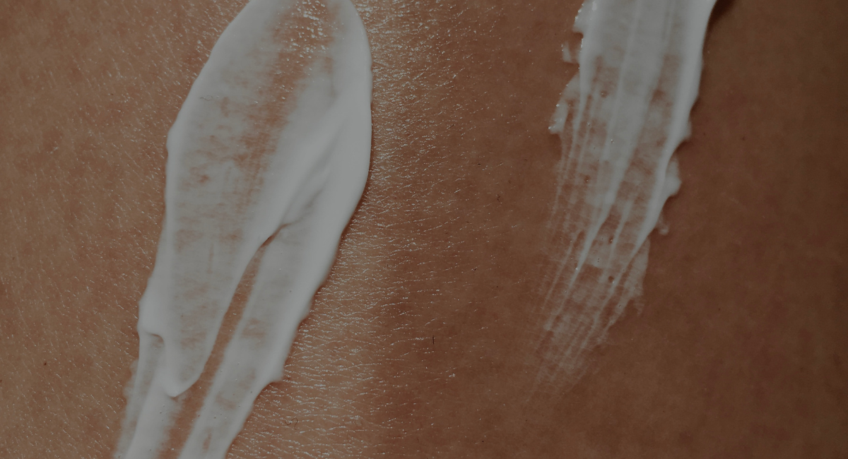Close up photo of face cream on a person's dry face